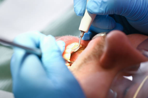 Best Broken Tooth Emergency  in Euharlee, GA
